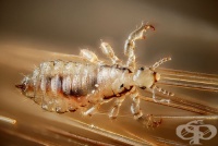 B85.0 Педикулоза, предизвикана от Pediculus humanus capitis