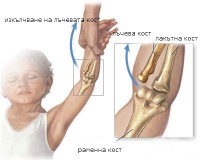 T92.3 ��������� �� ����������, ��������� � ��������� �� ����� �������