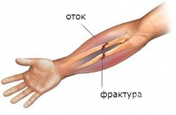 T92.1 ��������� �� �������� �� ����� �������, � ���������� �� ������� � ������