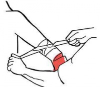 T92.6 ��������� �� �������� � ����������� ��������� �� ����� �������