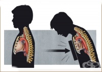 T91.4 ��������� �� ������ �� ����������� ������