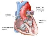 I01 Ревматизъм със засягане на сърцето