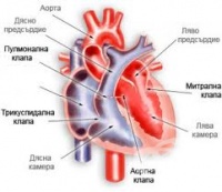 I06.1 Ревматична аортна инсуфициенция