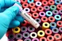 B06.0 Рубеола с неврологични усложнения