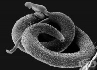 B65.1 ,   Schistosoma mansoni [ ]