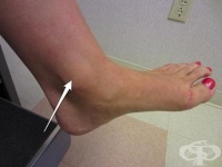 S82.5 �������� �� ��������� [��������] ��������