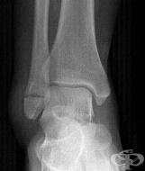 S82.6 �������� �� ������ [���������] ��������