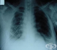 S28.0 �������� �� ������� ���