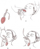 S17.0 �������� �� �������� � ��������