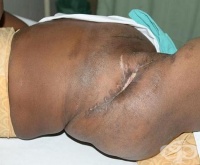 S77.0 �������� � �������� �� ������������� �����