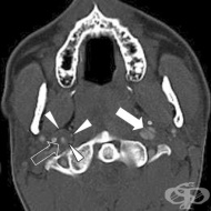 S17 �������� �� �����