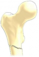 S72.2 �������������� ��������