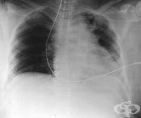 S26.9 ������ �� �������, ����������