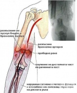 S45.1 ������ �� ����������� �������
