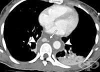 S25.8 ������ �� ����� ���������� ������ �� ������� ���