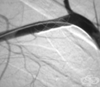 S15.8 ������ �� ����� ���������� ������ �� ���� ���