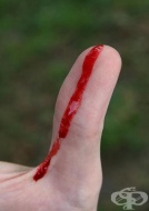 S65.4 ������ �� ����������(-��) ���(-���) �� ������