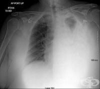 S25.9 ������ �� ��������� ���������� ��� �� ������� ���