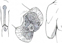 S48.1 ����������� ��������� �� ���� ����� ��������� � ��������� �����