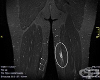 S76.4 ������ �� ����� � ���������� ������� � ��������� �� ���� �����