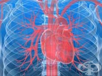 I23.8 Други текущи усложнения на острия инфаркт на миокарда