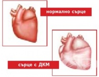 I43* Кардиомиопатия при болести, класифицирани другаде
