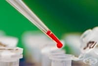 Скоро всички минали и настоящи вирусни инфекции на човек ще бъдат откривани с една капка кръв