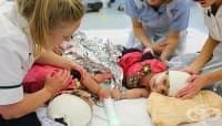 Британски лекари разделиха сиамски близначки след три сложни операции