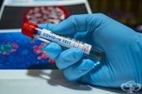 Нови 135 случая на COVID-19 и 256 излекувани на 18 август 2020-а