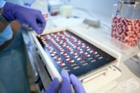 Изследователи от Русия разработват лечение на захарен диабет с клетки от панкреаса
