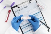 2814 положителни тестове за COVID-19 и 1971 оздравели на 1 декември 2020-а