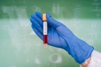 Лек спад на новите случаи на COVID-19 и 4600 оздравели на 21 януари 2021-ва