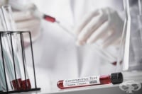 11 март 2021 г.: 20,3% положителни проби за COVID-19 при направени 13 691 теста