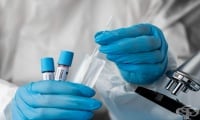 При две трети от случаите на Омикрон в Англия става въпрос за повторно заразяване