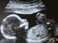 �������� � ���������� ���������� ����������� - ������ �� ��� ��-����� ��������