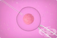 ���������������� ����������� ��������� �� ���� �������� ����� �� ����������� �� ����������