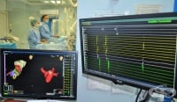 В пловдивската Университетска болница „Св. Георги“ прилагат 3D навигация при премахване на аритмия вместо рентген