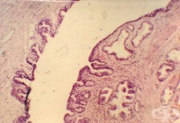 ��� 600 000 ���� � �������� �� ���������� �� �������� � ��������