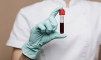 Кръвен тест открива болестта на Алцхаймер с над 90% точност