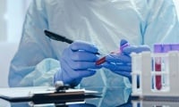 Кръвен тест открива с висока точност рак на дебелото черво