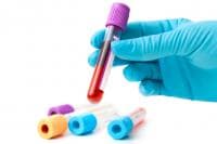 ������ ���� ���� ���� ������� � ������� � ������