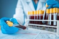 Нов кръвен тест открива рак на простатата, избягвайки инвазивните биопсии