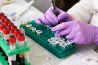 В МБАЛ „Христо Ботев“ – Враца отваря лаборатория за PCR тестове