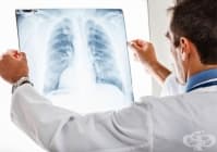 ����������� ����������� ���������� �� ����������� �� ��������� � ���