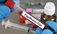 ��������� �� ����� 4 ������� ���� � ������ ������� ������� �� HPV