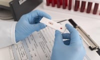 СЗО одобри първия бърз тест за маймунска шарка