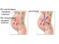Клинична патология при хемолитична болест на плода и новороденото