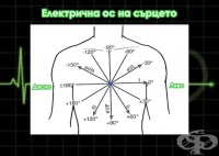 Електрична ос на сърцето
