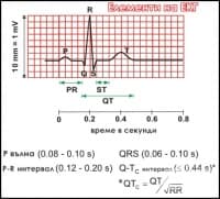 Елементи на ЕКГ