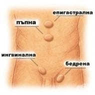 Херния